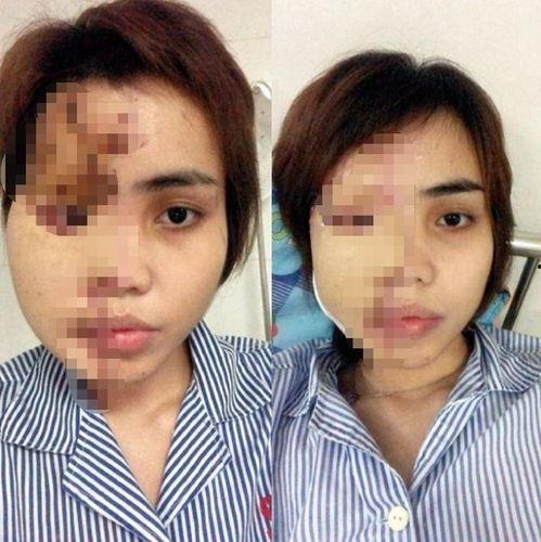 网红被毁容以后,美丽背后的阴影与反思